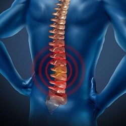 Características do disco intervertebral